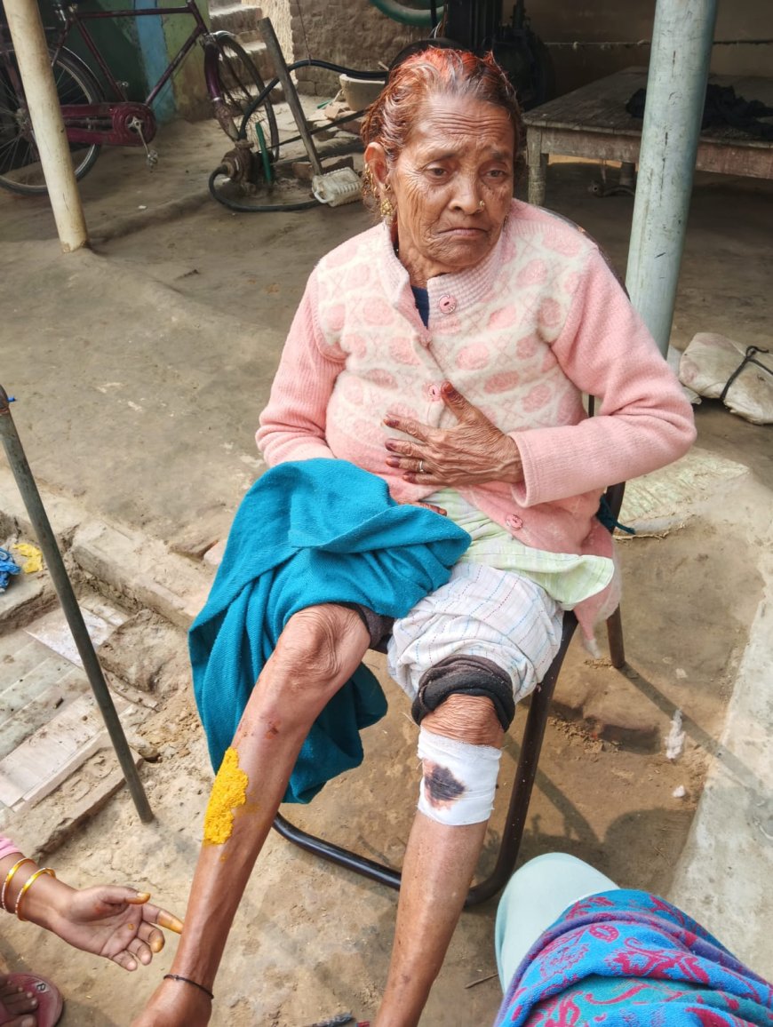 बीती रात बस्ती सड़क हादसे में संतकबीरनगर के यात्री घायल