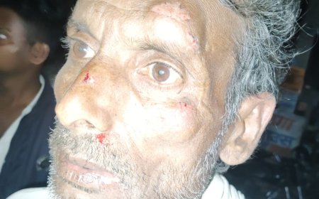 अनियंत्रित पिकअप ने साइकिल सवार सहित दो को रौंदा हालत गंभीर 