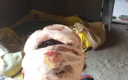 पुरानी रंजिश को लेकर मारपीट, कार्रवाई की मांग