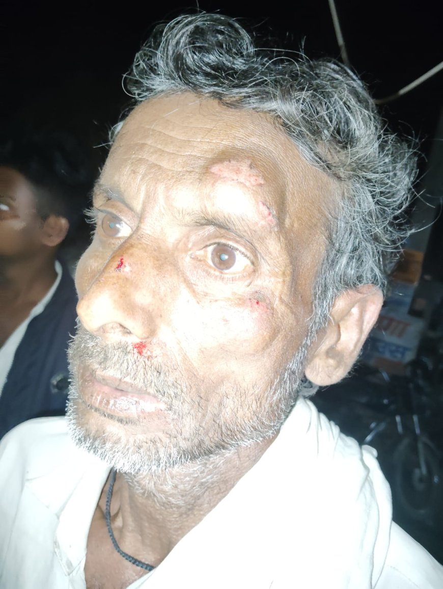 अनियंत्रित पिकअप ने साइकिल सवार सहित दो को रौंदा हालत गंभीर 