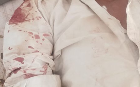 बाइक पेड़ से टकराकर दीवार से टकराई, चालक घायल