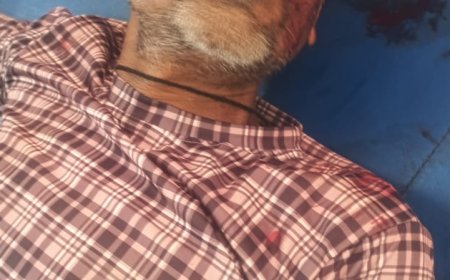 सड़क पार कर रहे व्यक्ति को बचाने के चक्कर मे बाइक सवार युवक घायल 