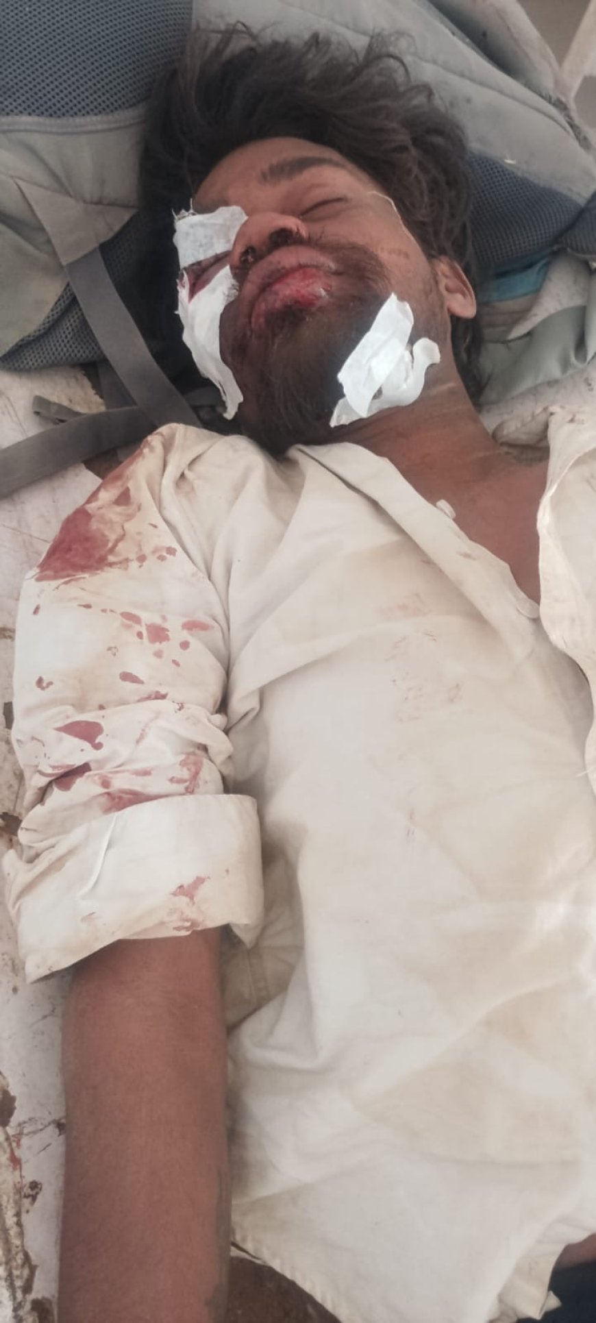 बाइक पेड़ से टकराकर दीवार से टकराई, चालक घायल