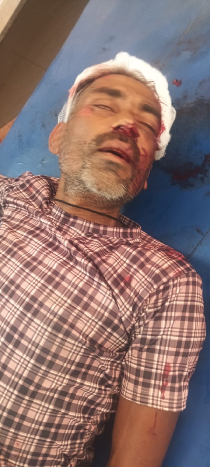 सड़क पार कर रहे व्यक्ति को बचाने के चक्कर मे बाइक सवार युवक घायल 