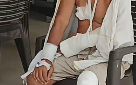 व्यापारी नेता पर चाकू से हमला, आसपास के लोगों ने हमलावर को दबोचकर बचाई जान