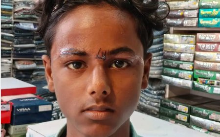 चाइनीज मांझे का कहरः मेंहदावल में मासूम बच्चा घायल 