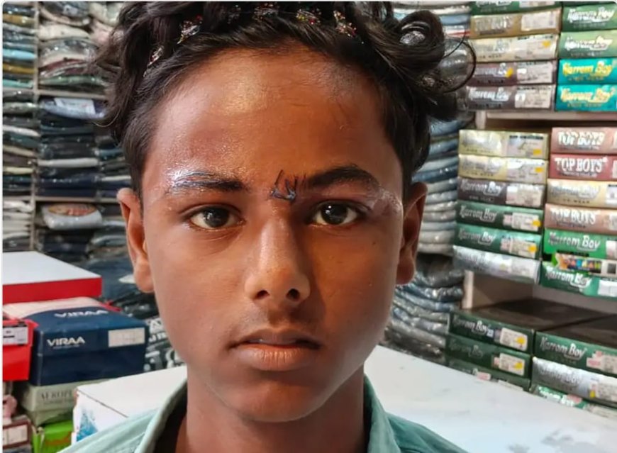 चाइनीज मांझे का कहरः मेंहदावल में मासूम बच्चा घायल 