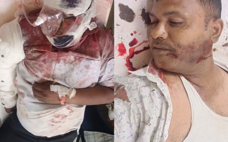 रैना पेपर मिल के सामने सड़क हादसे में बाइक सवार दो व्यक्तियों में एक की मौत, दूसरे की हालत गम्भीर